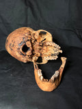 Item 15. Human skull with mandible