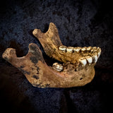 Item 7. A human mandible
