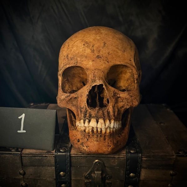 Item 1. Human skull with mandible