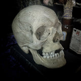 Medically prepared human skull
