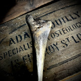 Human tibia (shinbone)