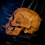Item 4. Human skull with mandible