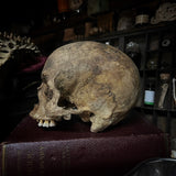Human skull