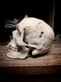 Medically prepared human skull