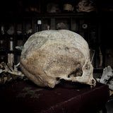 Human skull