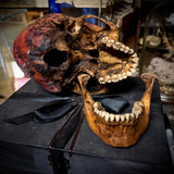Human skull with mandible