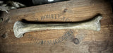 Human tibia