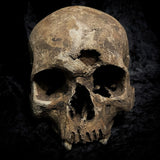 Human skull