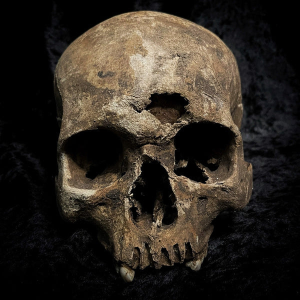 Human skull