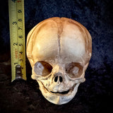 Item 1. Human fetal skull