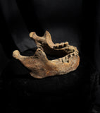 A mandible