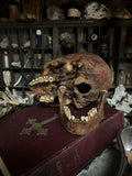 Human skull