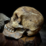 Large human skull with mandible