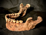 Item 10. Human mandible