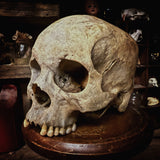 A human skull