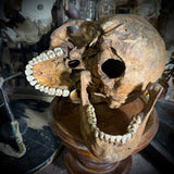 Human skull with mandible and brass teeth