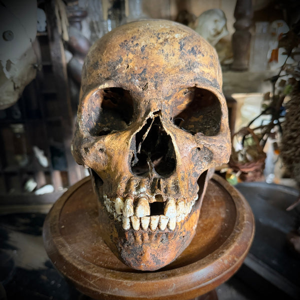 Human skull with mandible