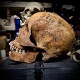 Human skull