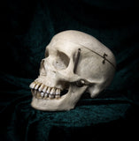 Medically prepared human skull