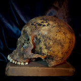 Item 7. Human skull
