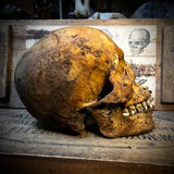 Human skull with mandible