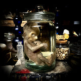 Fetal specimen