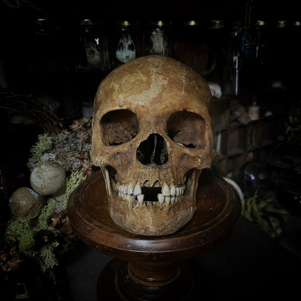 Human skull