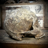 Human skull