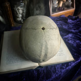 Medically prepared human skull