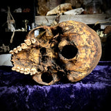 Human skull