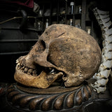 Human skull with mandible