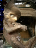 Fetal specimen