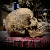 Human skull with mandible