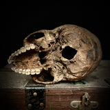 Human Skull