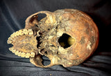Item 9. Human skull