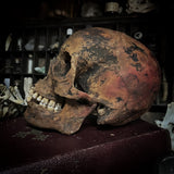 Human skull