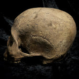 Human skull