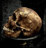 A human skull with mandible