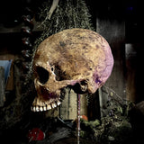 A human skull