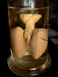 Item 3. Fetal lungs and heart