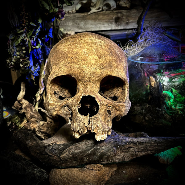 A human skull