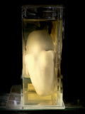 Foetal specimen