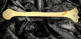 Human humerus (arm bone)