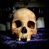 Human skull