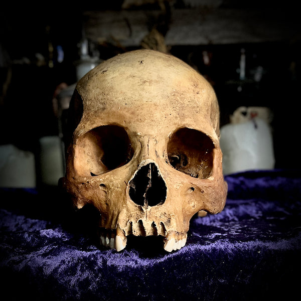 Human skull