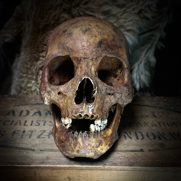 Human skull with mandible