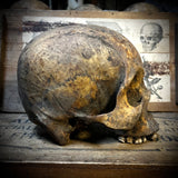 Human skull