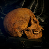 Item 4. Human skull with mandible