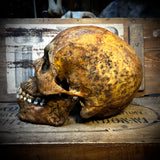 Human skull with mandible