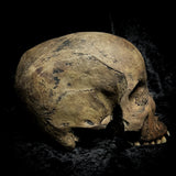 Human skull